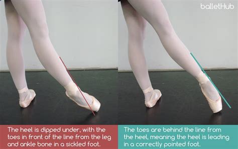 what is sickled feet in dance